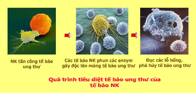 lieu phap dieu tri ung thu khong gay dau don